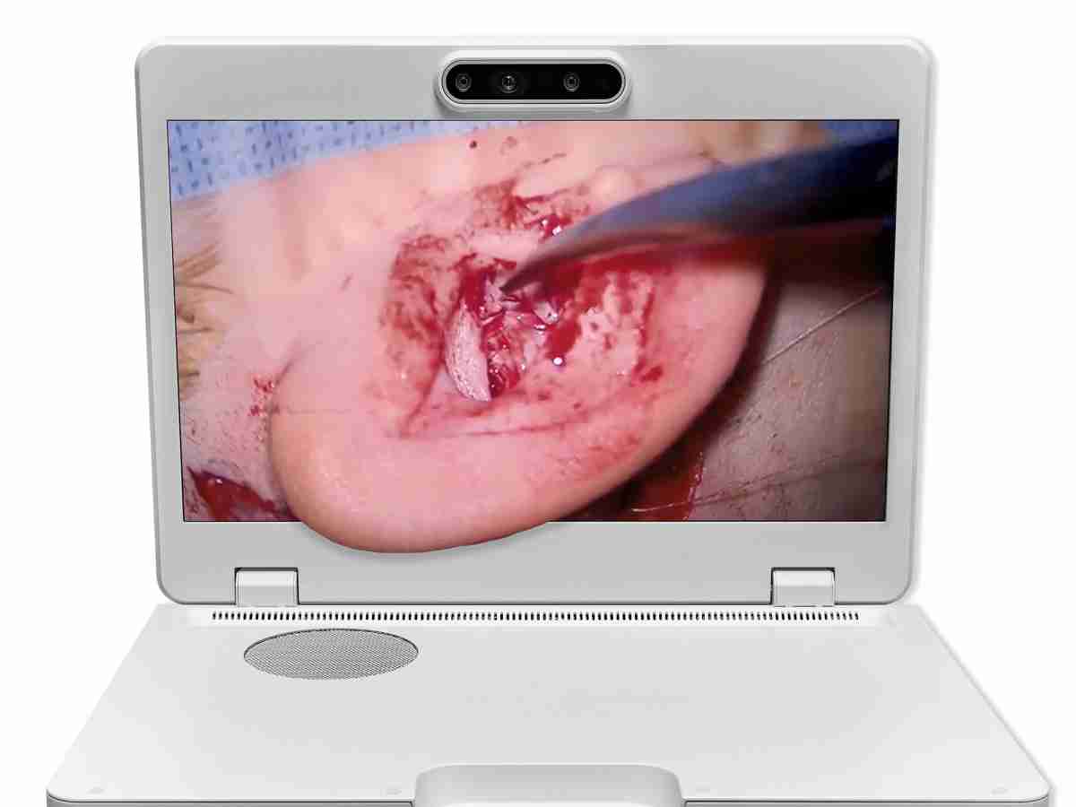 达擎之＂Heads-up 3D显微手术显示系统＂，，整合4K裸眼3D显示及眼球追踪系统，，，具备快速追踪人眼移动位置功能，，减轻医师长时间维持固定姿势的负担，，，，让医师能有更宽广清晰的3D立体视野及更舒适的姿势来执行手术。。